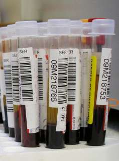 Blood_test